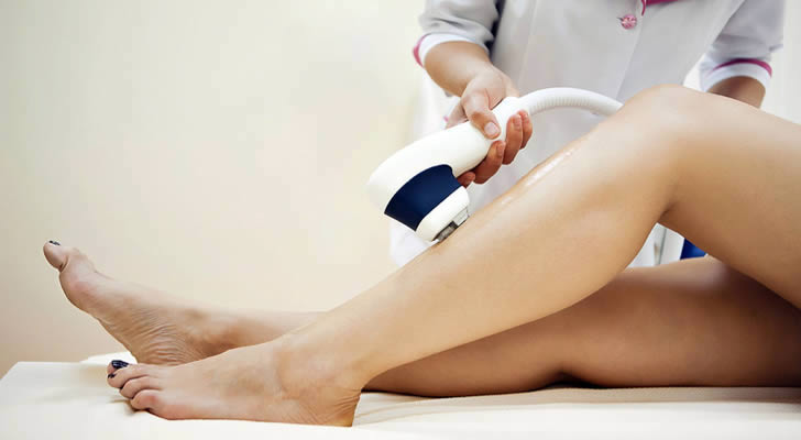 epilation laser 1